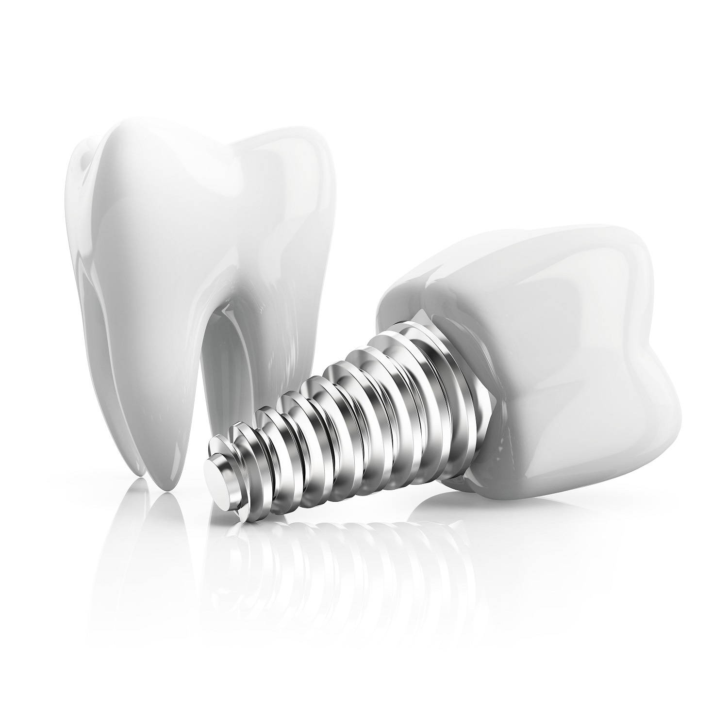 Dental Implants in Wall Township for a Complete Smile